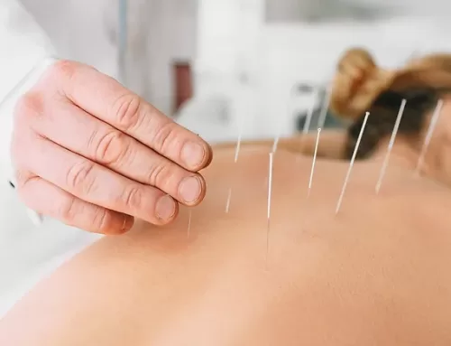 Top 7 Ways Acupuncture Can Support and Enhance Women’s Health