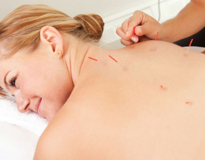 Chinese Medicine and Acupuncture Brunswick West