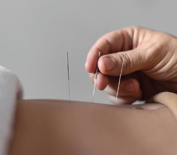 Acupuncture Brunswick