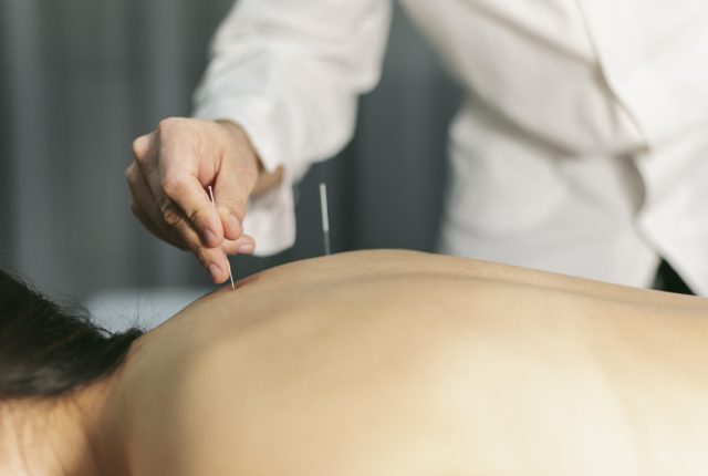 can acupuncture help anxiety