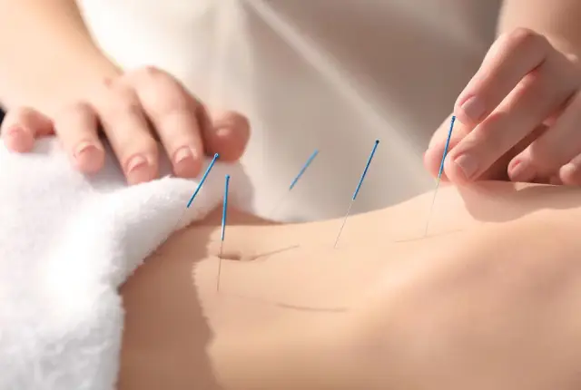 acupuncture for menstrual pain
